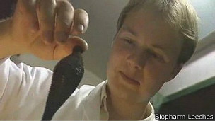 Hoy en día las sanguijuelas medicinales se crían en laboratorios.