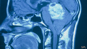 140217122232_monorail_304x171_spl