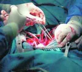 medicina-cirugia-corazon