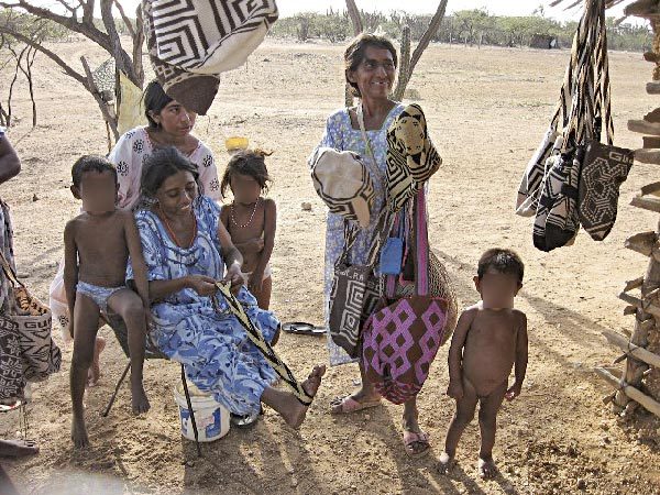 La desnutrición y las diferentes enfermedades que se registran en los niños y niñas de La Guajira también es consecuencia de la falta de atención médica en la zona.