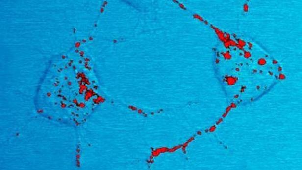 prion-virus-definicion