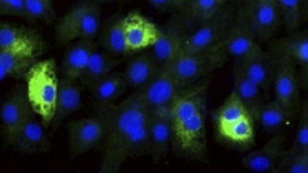 virus-definicion-ebola