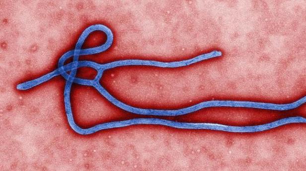 Virus-ebola-definicion